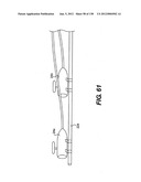 DIRECT DRIVE ENDOSCOPY SYSTEMS AND METHODS diagram and image