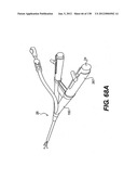 DIRECT DRIVE ENDOSCOPY SYSTEMS AND METHODS diagram and image