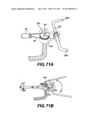 DIRECT DRIVE ENDOSCOPY SYSTEMS AND METHODS diagram and image