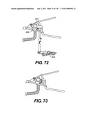 DIRECT DRIVE ENDOSCOPY SYSTEMS AND METHODS diagram and image