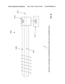 ROTATE-TO-ADVANCE CATHETERIZATION SYSTEM diagram and image