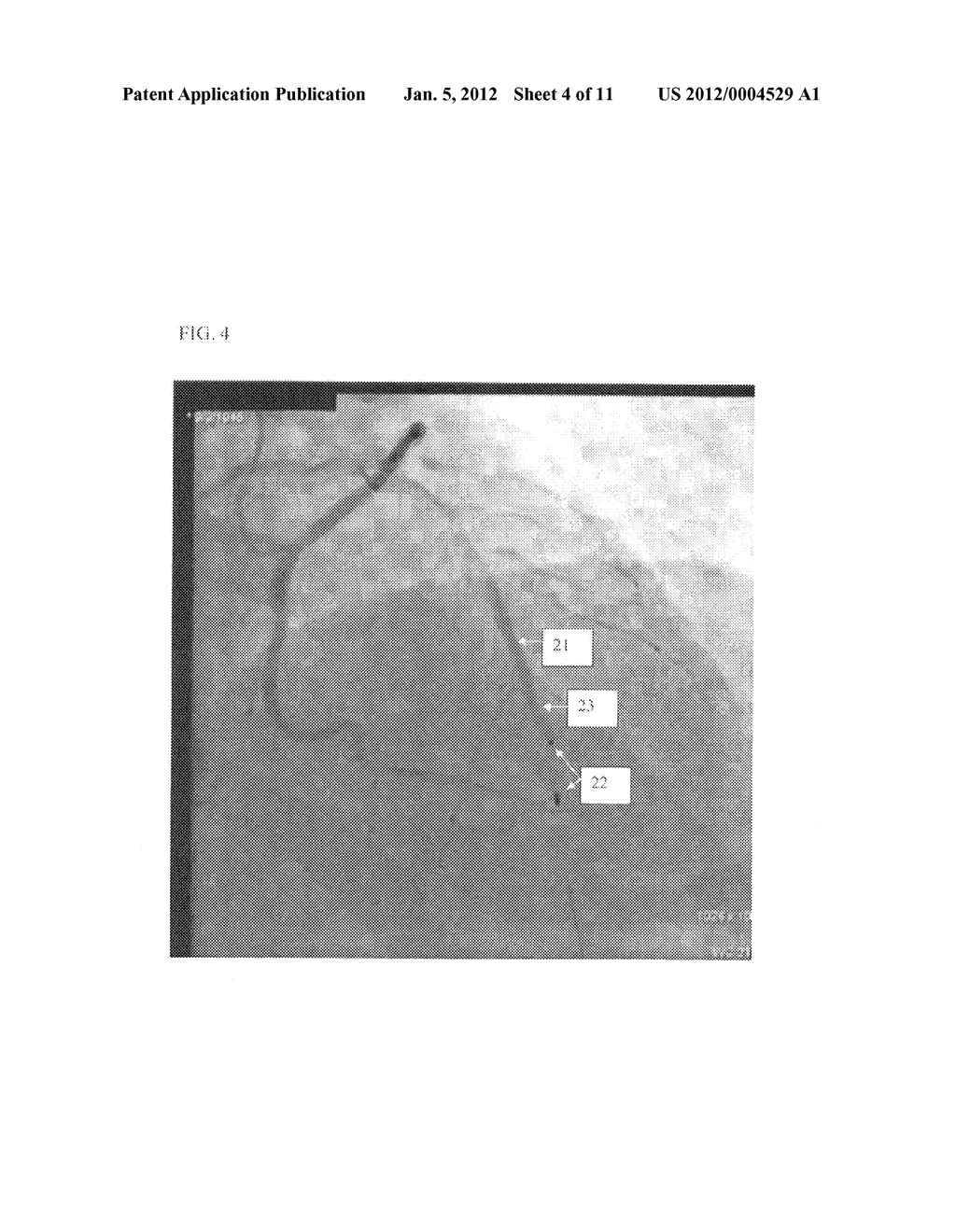 AUTOMATIC DISPLAY OF PREVIOUSLY-ACQUIRED ENDOLUMINAL IMAGES - diagram, schematic, and image 05