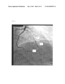 AUTOMATIC DISPLAY OF PREVIOUSLY-ACQUIRED ENDOLUMINAL IMAGES diagram and image