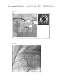 AUTOMATIC DISPLAY OF PREVIOUSLY-ACQUIRED ENDOLUMINAL IMAGES diagram and image