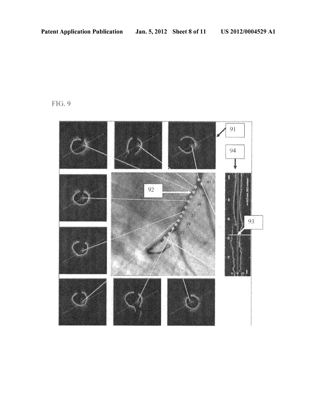 AUTOMATIC DISPLAY OF PREVIOUSLY-ACQUIRED ENDOLUMINAL IMAGES - diagram, schematic, and image 09