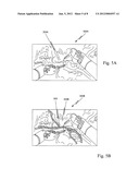 METHOD AND SYSTEM FOR FLUORESCENT IMAGING WITH BACKGROUND SURGICAL IMAGE     COMPOSED OF SELECTIVE ILLUMINATION SPECTRA diagram and image