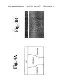 DYNAMIC MOTION CONTRAST AND TRANSVERSE FLOW ESTIMATION USING OPTICAL     COHERENCE TOMOGRAPHY diagram and image