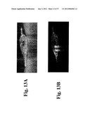 DYNAMIC MOTION CONTRAST AND TRANSVERSE FLOW ESTIMATION USING OPTICAL     COHERENCE TOMOGRAPHY diagram and image