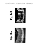 DYNAMIC MOTION CONTRAST AND TRANSVERSE FLOW ESTIMATION USING OPTICAL     COHERENCE TOMOGRAPHY diagram and image