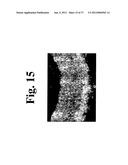 DYNAMIC MOTION CONTRAST AND TRANSVERSE FLOW ESTIMATION USING OPTICAL     COHERENCE TOMOGRAPHY diagram and image