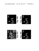 DYNAMIC MOTION CONTRAST AND TRANSVERSE FLOW ESTIMATION USING OPTICAL     COHERENCE TOMOGRAPHY diagram and image