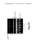 DYNAMIC MOTION CONTRAST AND TRANSVERSE FLOW ESTIMATION USING OPTICAL     COHERENCE TOMOGRAPHY diagram and image