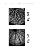 DYNAMIC MOTION CONTRAST AND TRANSVERSE FLOW ESTIMATION USING OPTICAL     COHERENCE TOMOGRAPHY diagram and image