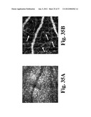 DYNAMIC MOTION CONTRAST AND TRANSVERSE FLOW ESTIMATION USING OPTICAL     COHERENCE TOMOGRAPHY diagram and image