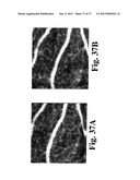 DYNAMIC MOTION CONTRAST AND TRANSVERSE FLOW ESTIMATION USING OPTICAL     COHERENCE TOMOGRAPHY diagram and image