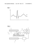 Method for Generating a Trigger Signal by an EKG Signal as Well as an EKG     Measuring Apparatus and a Magnetic Resonance Device diagram and image