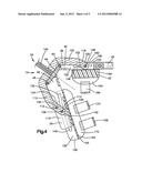 FINGER ORTHOSIS diagram and image