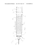 Catheter for Use in Revascularization Procedures and Method of Using Same diagram and image