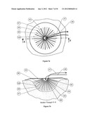 WOUND DRESSING APPARATUS AND METHOD OF USE diagram and image