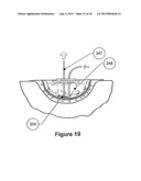 WOUND DRESSING APPARATUS AND METHOD OF USE diagram and image