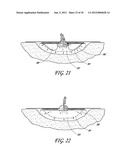 WOUND DRESSING APPARATUS AND METHOD OF USE diagram and image