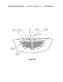 WOUND DRESSING APPARATUS AND METHOD OF USE diagram and image