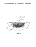 WOUND DRESSING APPARATUS AND METHOD OF USE diagram and image