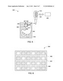 IMPLANTABLE DEVICE SYSTEM diagram and image