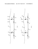 ROBOTIC CATHETER SYSTEM diagram and image