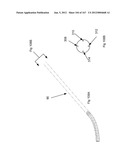 ROBOTIC CATHETER SYSTEM diagram and image