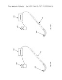 ROBOTIC CATHETER SYSTEM diagram and image