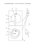 ROBOTIC CATHETER SYSTEM diagram and image