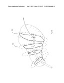 ROBOTIC CATHETER SYSTEM diagram and image