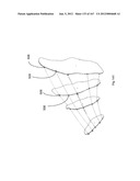 ROBOTIC CATHETER SYSTEM diagram and image