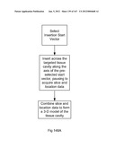 ROBOTIC CATHETER SYSTEM diagram and image