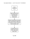 ROBOTIC CATHETER SYSTEM diagram and image