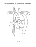 ROBOTIC CATHETER SYSTEM diagram and image