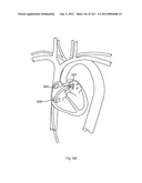 ROBOTIC CATHETER SYSTEM diagram and image