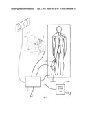 ROBOTIC CATHETER SYSTEM diagram and image