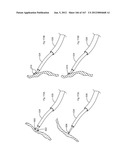 ROBOTIC CATHETER SYSTEM diagram and image