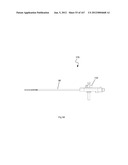 ROBOTIC CATHETER SYSTEM diagram and image