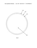 ROBOTIC CATHETER SYSTEM diagram and image