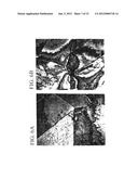 Platinum Enhanced Alloy and Intravascular or Implantable Medical Devices     Manufactured Therefrom diagram and image