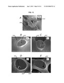 DEGRADATION RESISTANT IMPLANTABLE MATERIALS AND METHODS diagram and image