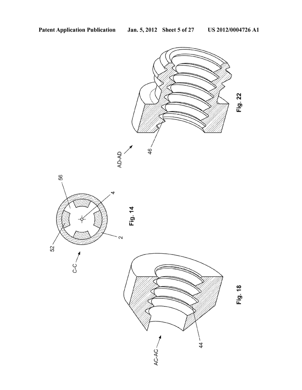 EXPANDABLE SUPPORT DEVICE AND METHOD OF USE - diagram, schematic, and image 06