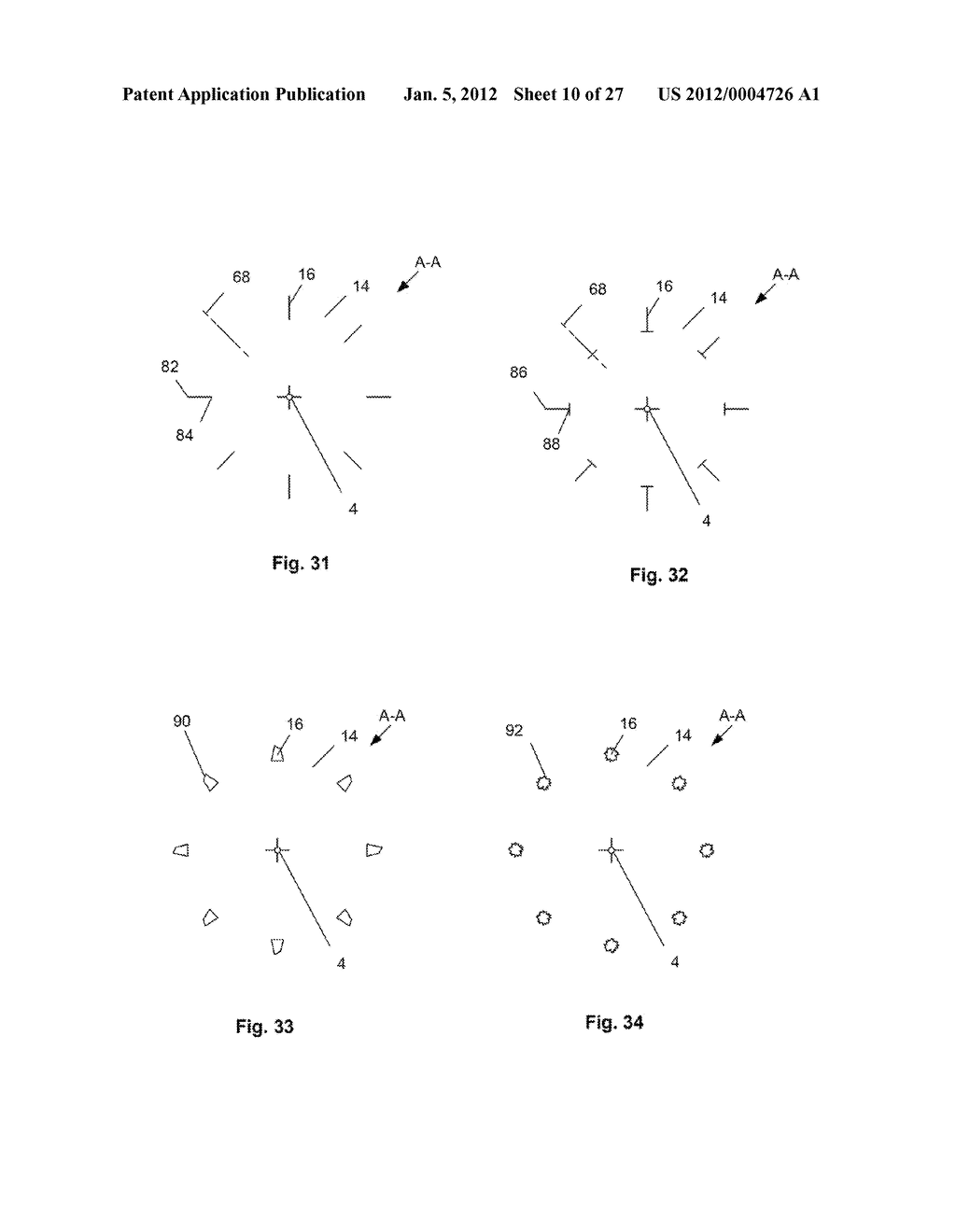 EXPANDABLE SUPPORT DEVICE AND METHOD OF USE - diagram, schematic, and image 11