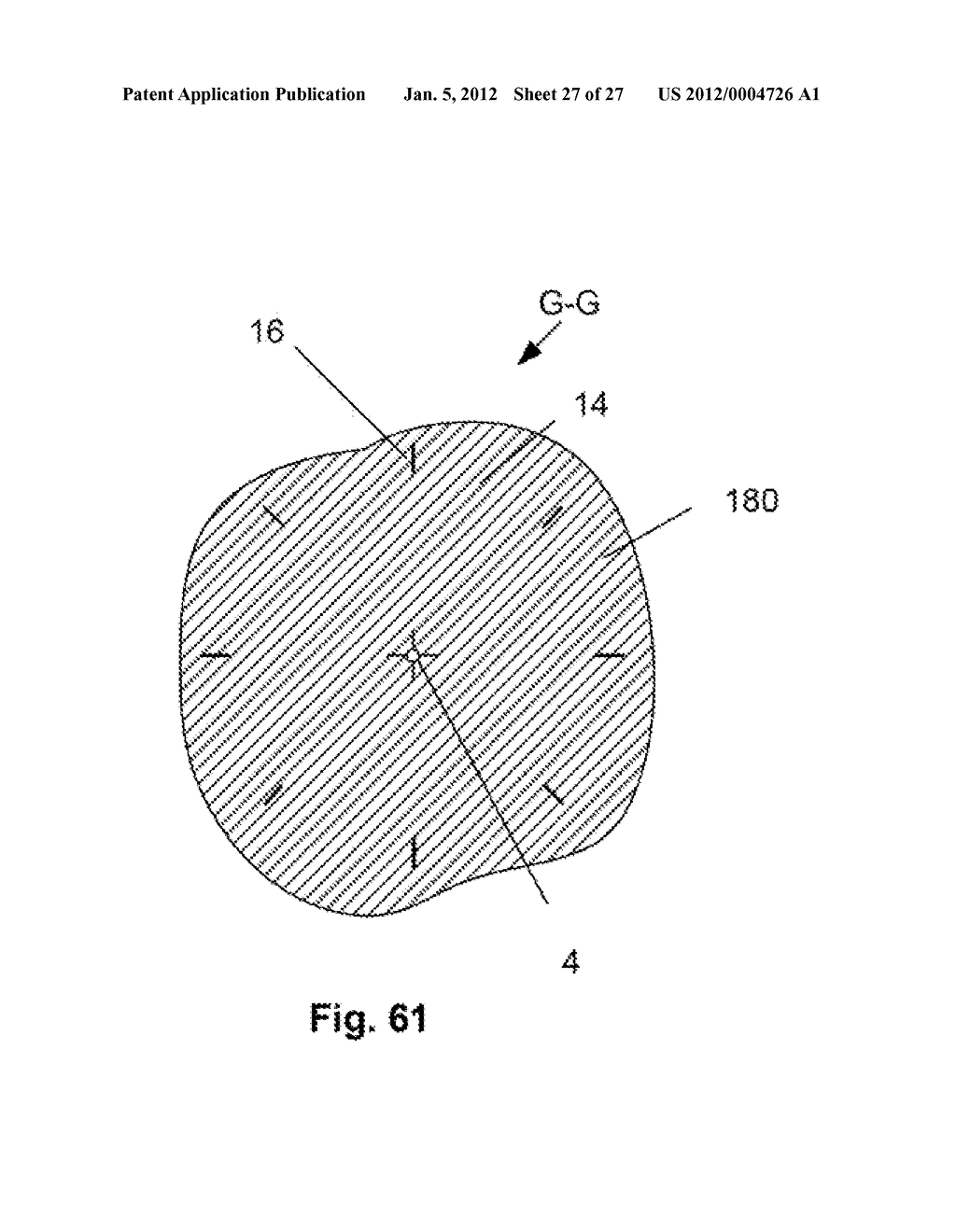 EXPANDABLE SUPPORT DEVICE AND METHOD OF USE - diagram, schematic, and image 28