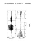 MULTI-PARAMETRIC ANALYSIS OF SNORE SOUNDS FOR THE COMMUNITY SCREENING OF     SLEEP APNEA WITH NON-GAUSSIANITY INDEX diagram and image