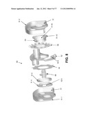 CAST REMOVAL SYSTEM diagram and image