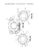 CAST REMOVAL SYSTEM diagram and image